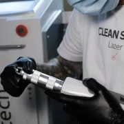 Студия удаления тату Clean Skin Laser фото 2 на сайте Sokolinayagora.su