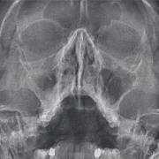 Центр рентгенодиагностики Пикассо на Семёновской площади фото 1 на сайте Sokolinayagora.su